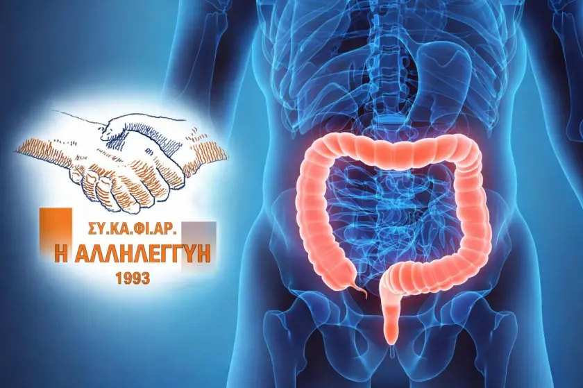 Δωρεάν κολονοσκοπήσεις στην Αργολίδα από τον ΣΥ.ΚΑ.ΦΙ.ΑΡ.